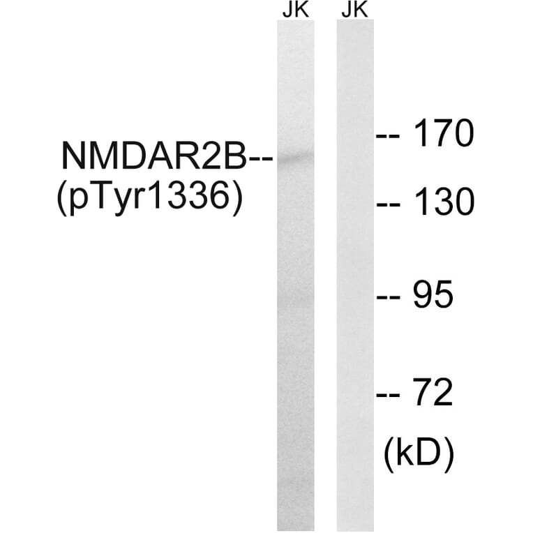 Western Blot - Anti-NMDAR2B (phospho Tyr1336) Antibody (A8257) - Antibodies.com