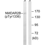 Western Blot - Anti-NMDAR2B (phospho Tyr1336) Antibody (A8257) - Antibodies.com