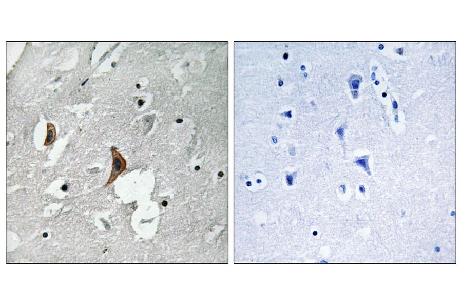 Immunohistochemistry - Anti-NMDAR2B (phospho Tyr1336) Antibody (A8257) - Antibodies.com