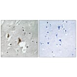 Immunohistochemistry - Anti-NMDAR2B (phospho Tyr1336) Antibody (A8257) - Antibodies.com