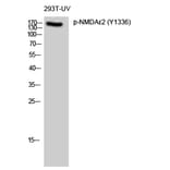 Western Blot - Anti-NMDAR2B (phospho Tyr1336) Antibody (A8257) - Antibodies.com
