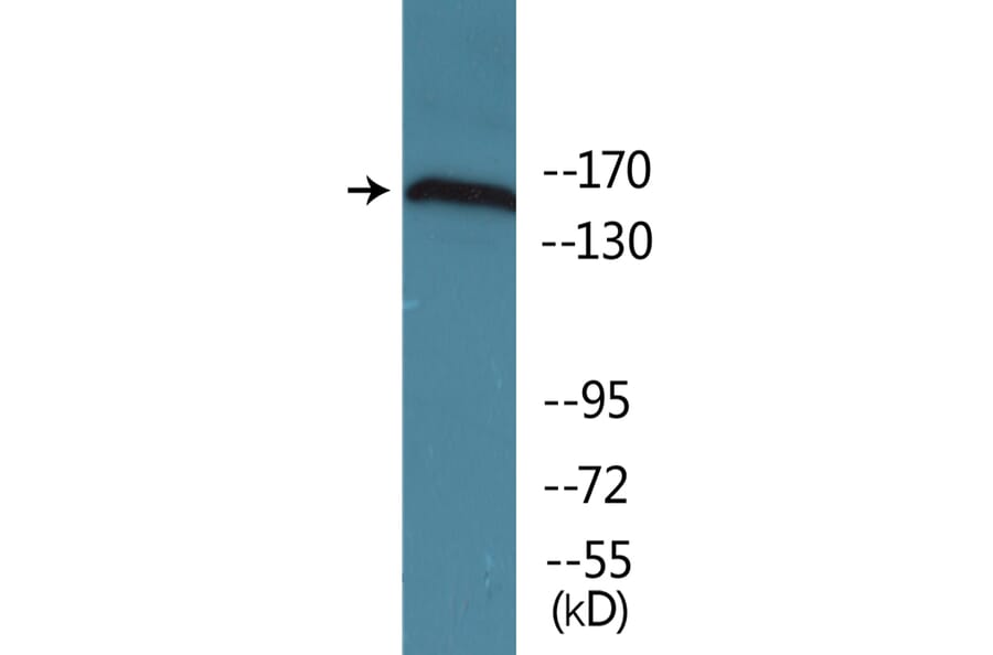 Western Blot - Anti-NMDAR2B (phospho Tyr1336) Antibody (P12-1155) - Antibodies.com
