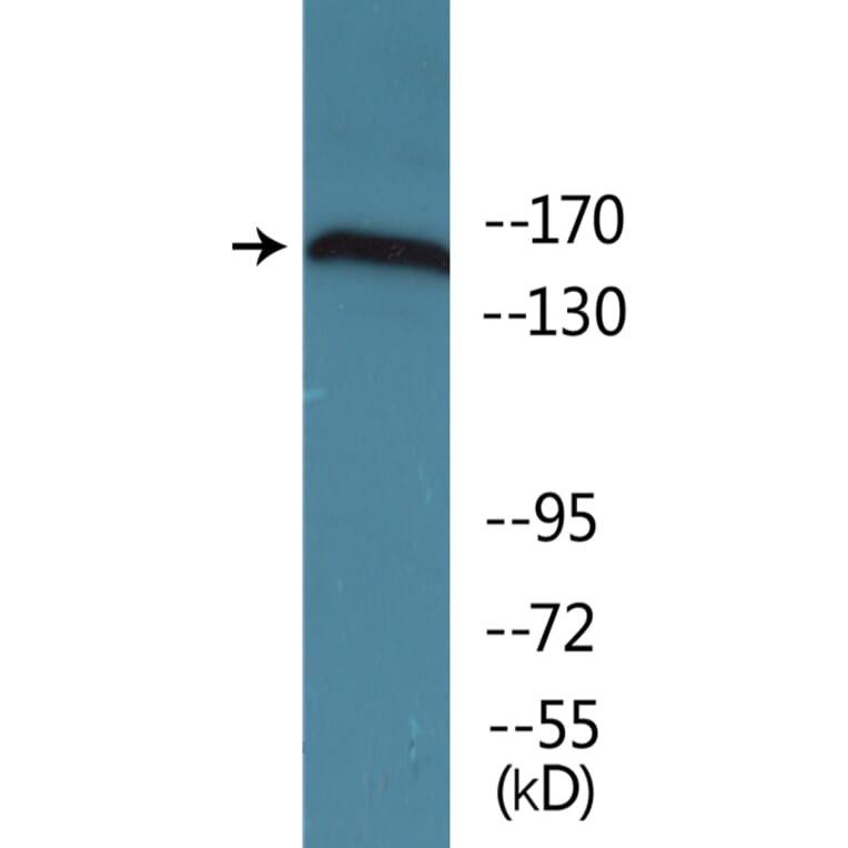Western Blot - Anti-NMDAR2B (phospho Tyr1336) Antibody (P12-1155) - Antibodies.com