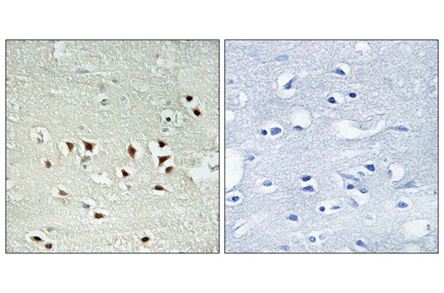 Immunohistochemistry - Anti-MAPKAPK2 (phospho Thr334) Antibody (A0018) - Antibodies.com