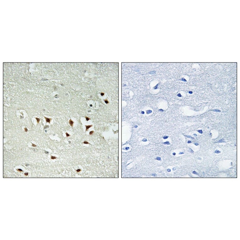 Immunohistochemistry - Anti-MAPKAPK2 (phospho Thr334) Antibody (A0018) - Antibodies.com