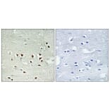 Immunohistochemistry - Anti-MAPKAPK2 (phospho Thr334) Antibody (A0018) - Antibodies.com
