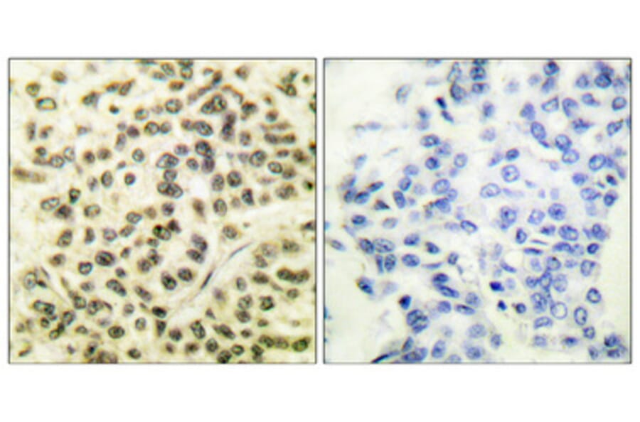Immunohistochemistry - Anti-MAPKAPK2 (phospho Thr334) Antibody (A0018) - Antibodies.com