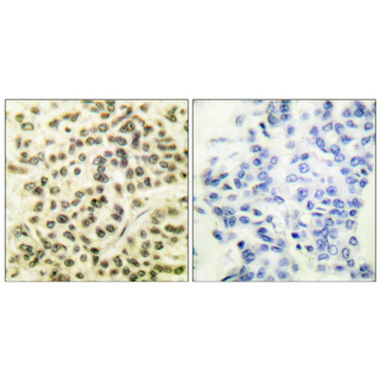 Immunohistochemistry - Anti-MAPKAPK2 (phospho Thr334) Antibody (A0018) - Antibodies.com