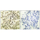Immunohistochemistry - Anti-MAPKAPK2 (phospho Thr334) Antibody (A0018) - Antibodies.com