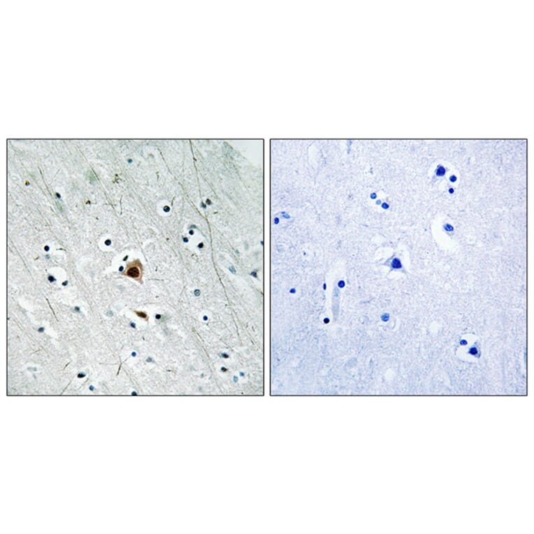 Immunohistochemistry - Anti-MAPKAPK2 (phospho Ser272) Antibody (A8363) - Antibodies.com