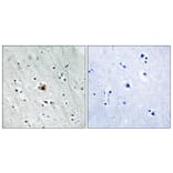 Immunohistochemistry - Anti-MAPKAPK2 (phospho Ser272) Antibody (A8363) - Antibodies.com