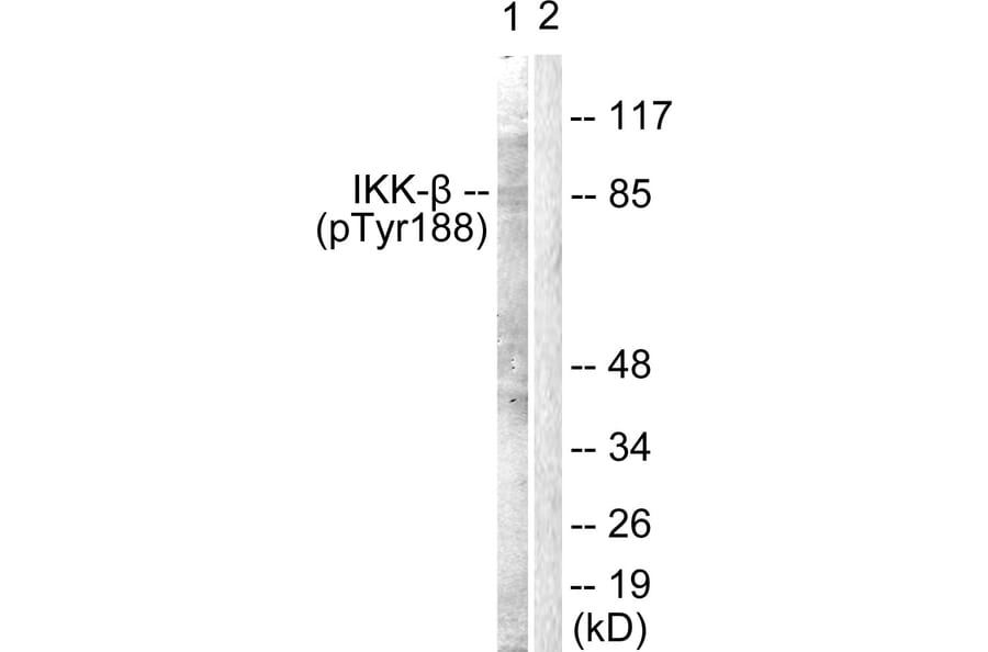 Western Blot - Anti-IKK-beta (phospho Tyr188) Antibody (A0442) - Antibodies.com