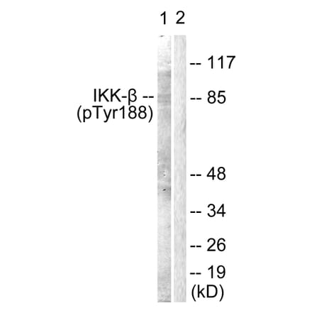 Western Blot - Anti-IKK-beta (phospho Tyr188) Antibody (A0442) - Antibodies.com