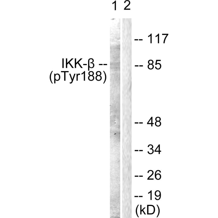 Western Blot - Anti-IKK-beta (phospho Tyr188) Antibody (A0442) - Antibodies.com