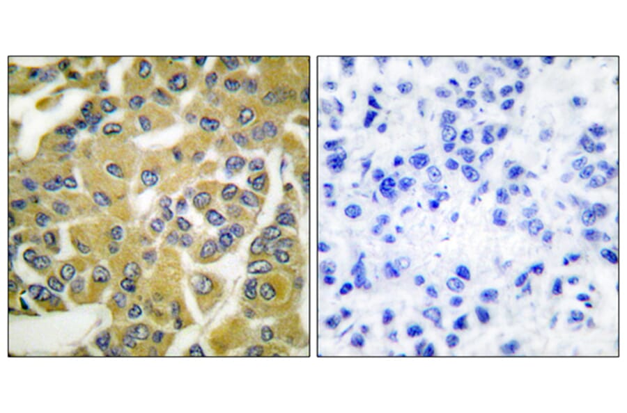 Immunohistochemistry - Anti-IKK-beta (phospho Tyr188) Antibody (A0442) - Antibodies.com