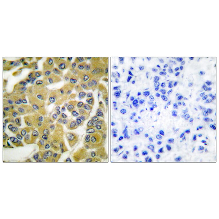 Immunohistochemistry - Anti-IKK-beta (phospho Tyr188) Antibody (A0442) - Antibodies.com