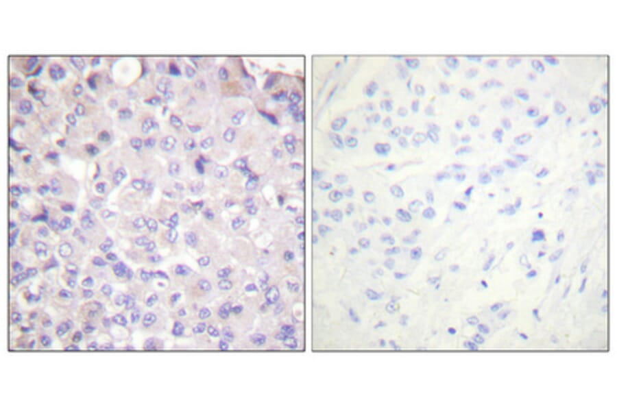 Immunohistochemistry - Anti-IKK-beta (phospho Tyr188) Antibody (A0442) - Antibodies.com