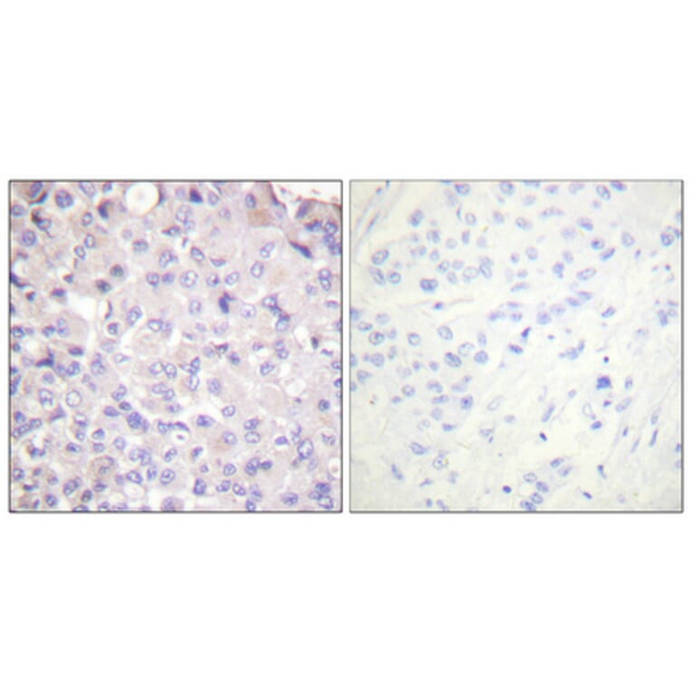 Immunohistochemistry - Anti-IKK-beta (phospho Tyr188) Antibody (A0442) - Antibodies.com