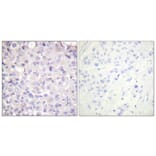 Immunohistochemistry - Anti-IKK-beta (phospho Tyr188) Antibody (A0442) - Antibodies.com