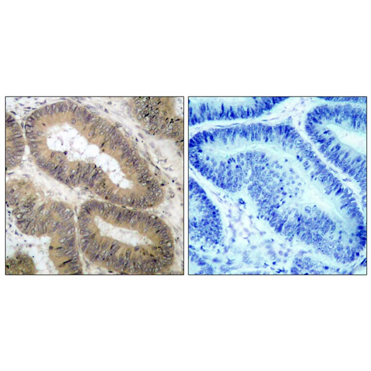 Immunohistochemistry - Anti-IKK-alpha (phospho Thr23) Antibody (A7117) - Antibodies.com