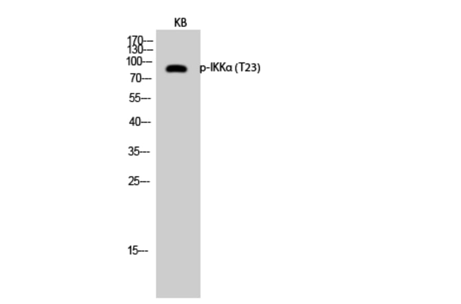 Western Blot - Anti-IKK-alpha (phospho Thr23) Antibody (A7117) - Antibodies.com