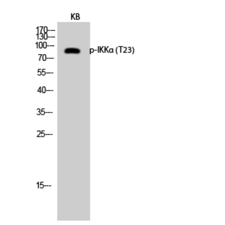 Western Blot - Anti-IKK-alpha (phospho Thr23) Antibody (A7117) - Antibodies.com