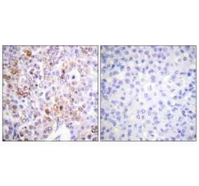 Immunohistochemistry - Anti-Histone H4 (acetyl Lys16) Antibody (D0014) - Antibodies.com