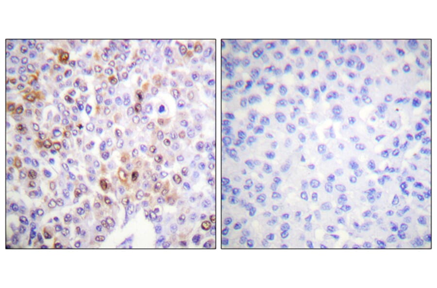 Immunohistochemistry - Anti-Histone H4 (acetyl Lys16) Antibody (D0014) - Antibodies.com