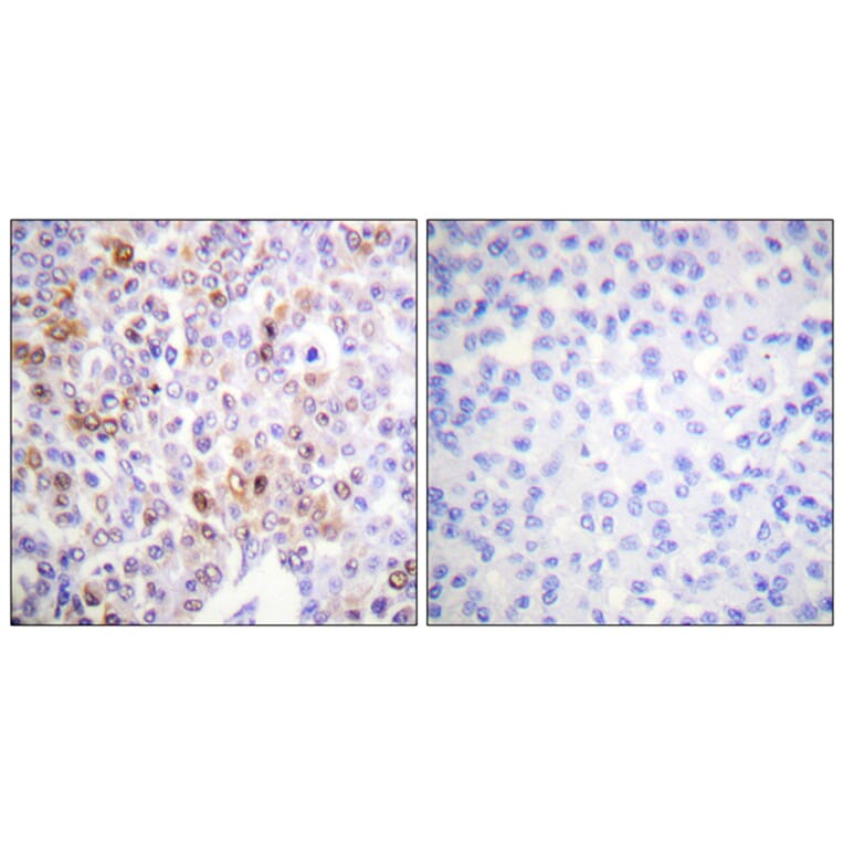 Immunohistochemistry - Anti-Histone H4 (acetyl Lys16) Antibody (D0014) - Antibodies.com