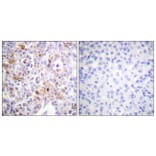Immunohistochemistry - Anti-Histone H4 (acetyl Lys16) Antibody (D0014) - Antibodies.com