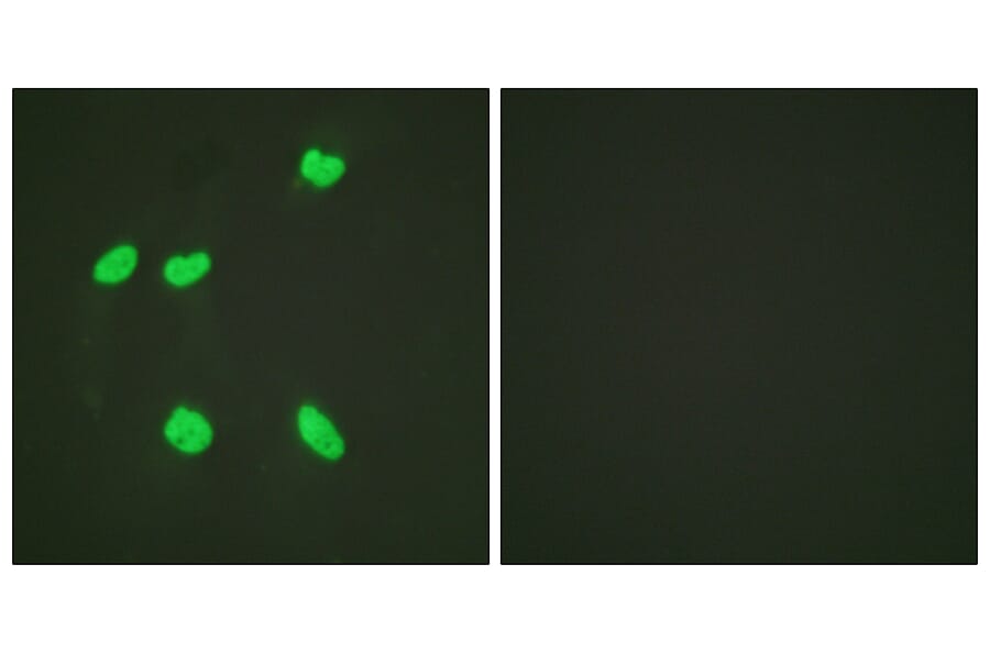 Immunofluorescence - Anti-Histone H4 (acetyl Lys16) Antibody (D0014) - Antibodies.com