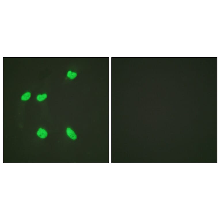 Immunofluorescence - Anti-Histone H4 (acetyl Lys16) Antibody (D0014) - Antibodies.com
