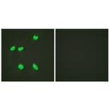 Immunofluorescence - Anti-Histone H4 (acetyl Lys16) Antibody (D0014) - Antibodies.com