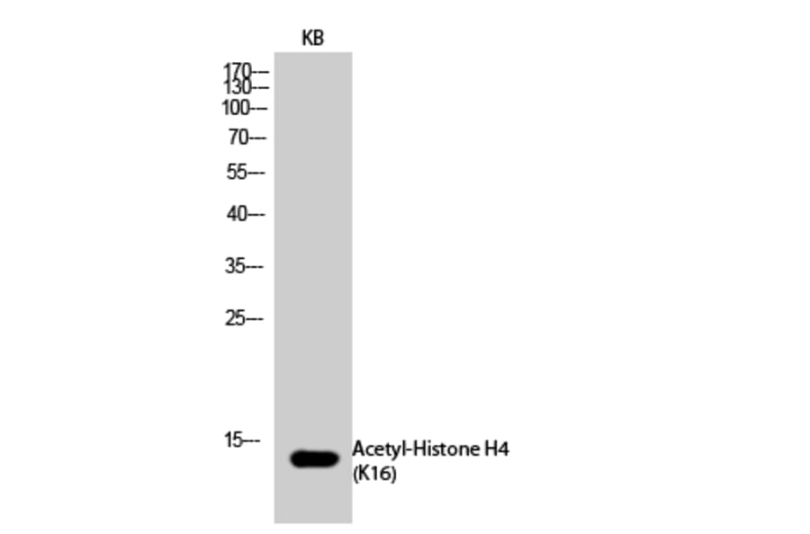 Western Blot - Anti-Histone H4 (acetyl Lys16) Antibody (D0014) - Antibodies.com