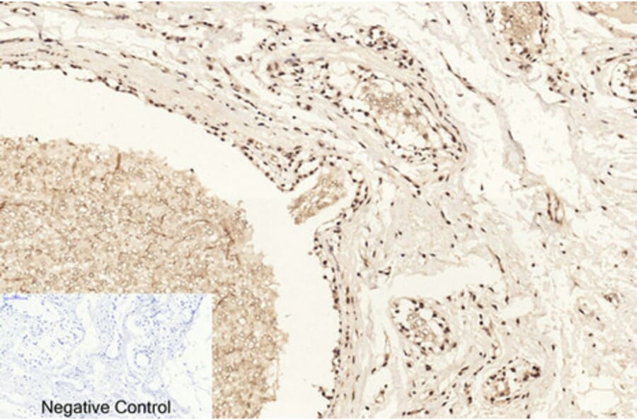 Immunohistochemistry - Anti-Histone H4 (acetyl Lys16) Antibody (D0014) - Antibodies.com