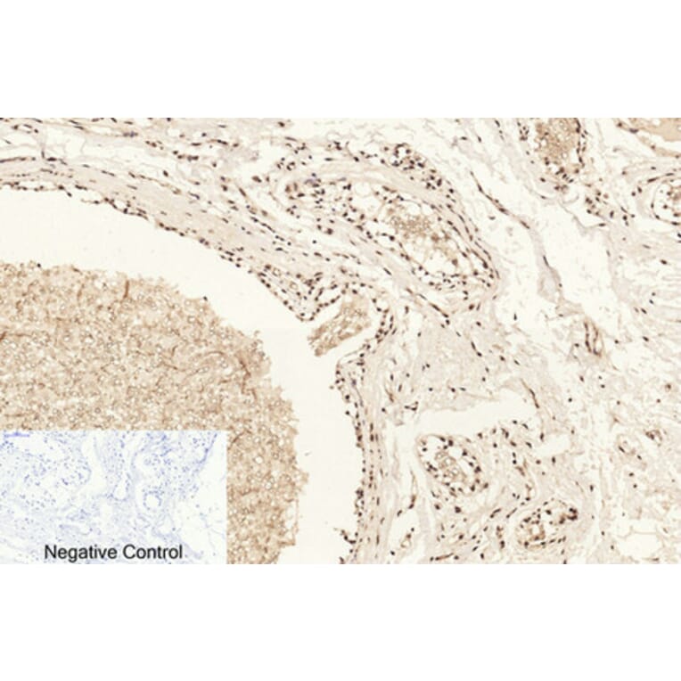 Immunohistochemistry - Anti-Histone H4 (acetyl Lys16) Antibody (D0014) - Antibodies.com