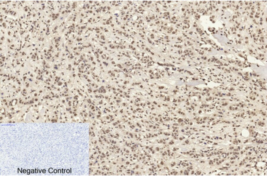 Immunohistochemistry - Anti-Histone H4 (acetyl Lys16) Antibody (D0014) - Antibodies.com