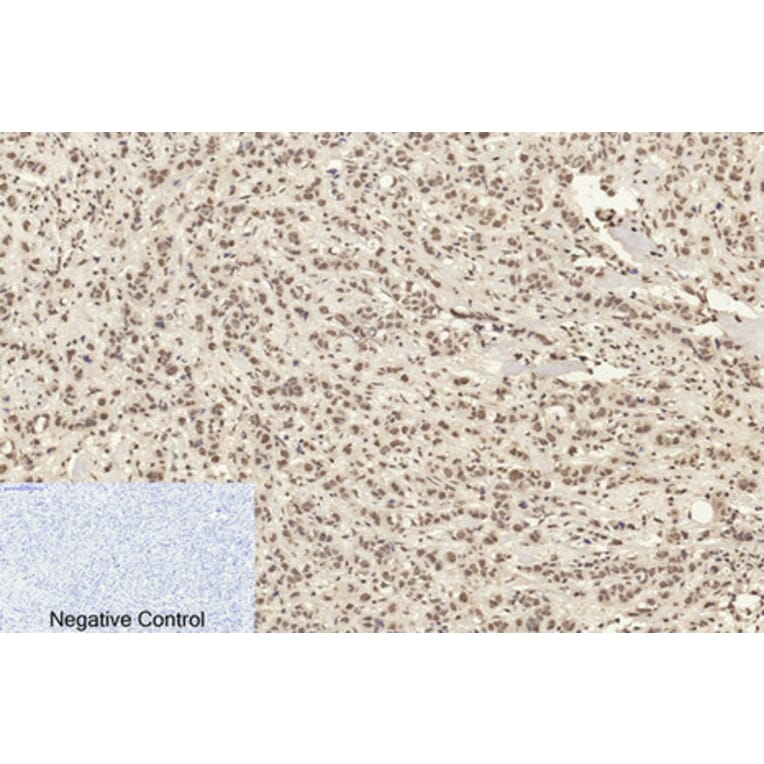 Immunohistochemistry - Anti-Histone H4 (acetyl Lys16) Antibody (D0014) - Antibodies.com