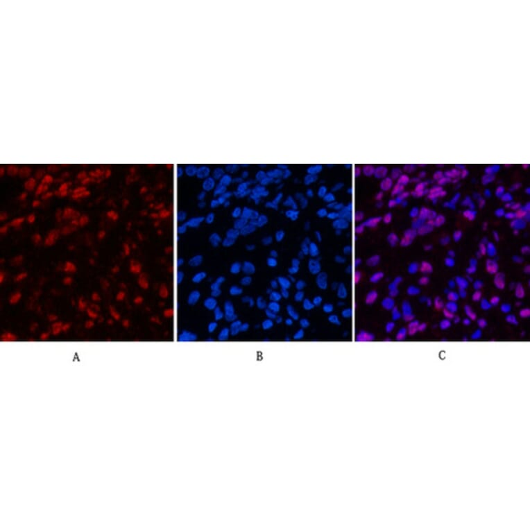 Immunofluorescence - Anti-Histone H4 (acetyl Lys16) Antibody (D0014) - Antibodies.com