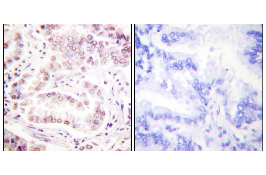 Immunohistochemistry - Anti-Histone H3 (acetyl Lys27) Antibody (D0010) - Antibodies.com