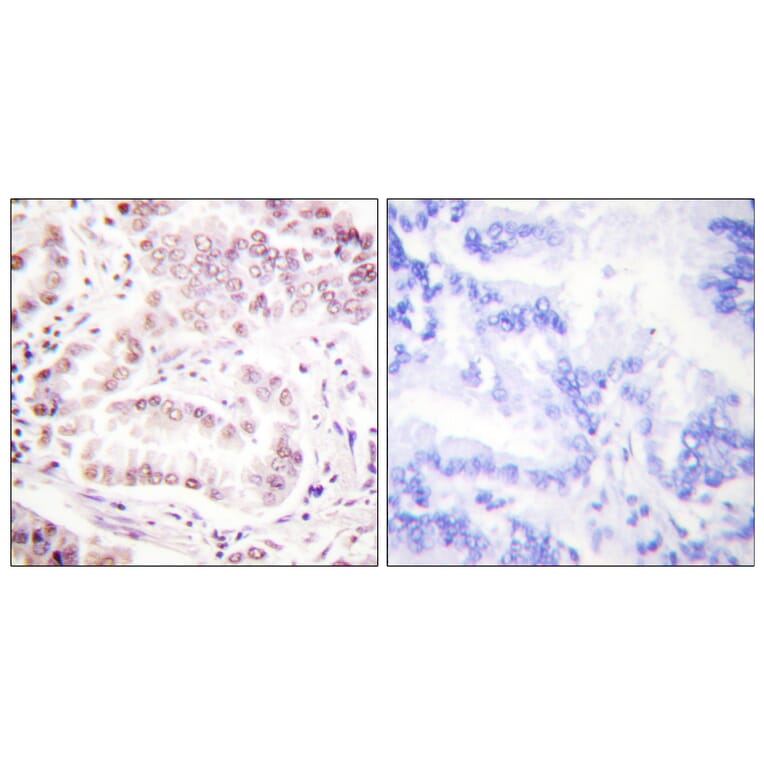Immunohistochemistry - Anti-Histone H3 (acetyl Lys27) Antibody (D0010) - Antibodies.com