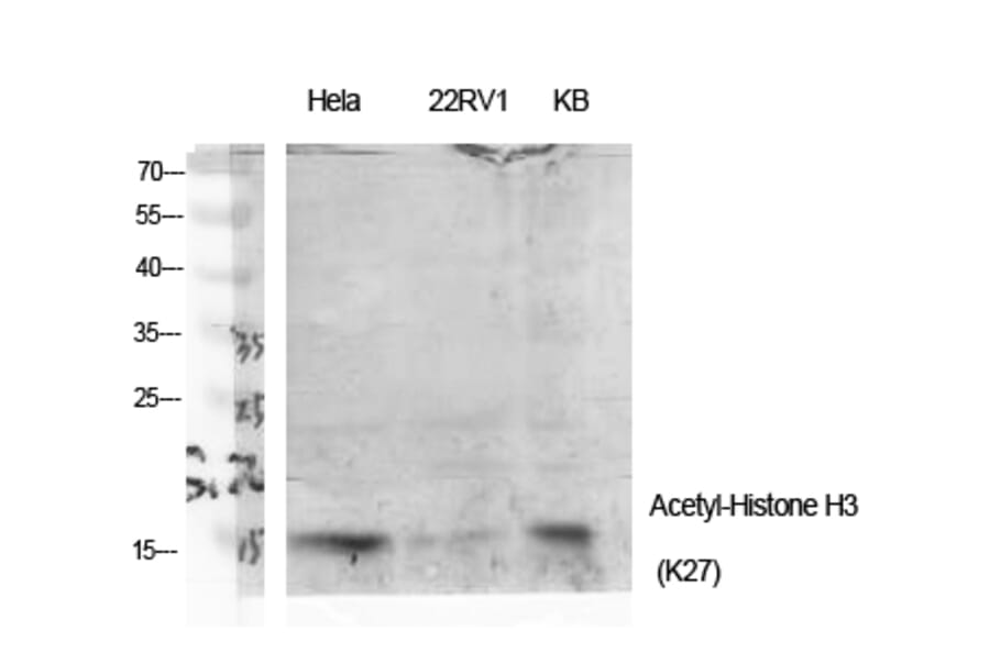 Western Blot - Anti-Histone H3 (acetyl Lys27) Antibody (D0010) - Antibodies.com