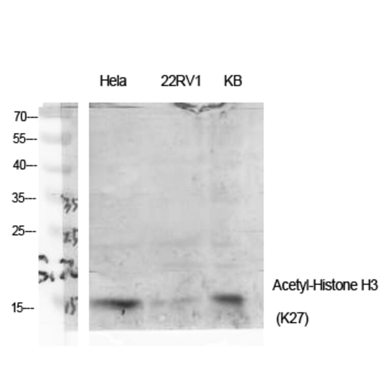 Western Blot - Anti-Histone H3 (acetyl Lys27) Antibody (D0010) - Antibodies.com