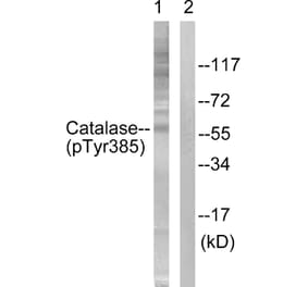Western Blot - Anti-Catalase (phospho Tyr385) Antibody (A0836) - Antibodies.com