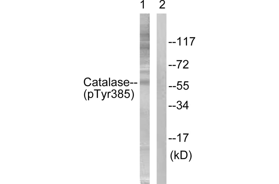 Western Blot - Anti-Catalase (phospho Tyr385) Antibody (A0836) - Antibodies.com