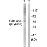Western Blot - Anti-Catalase (phospho Tyr385) Antibody (A0836) - Antibodies.com