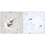 Immunohistochemistry - Anti-Catalase (phospho Tyr385) Antibody (A0836) - Antibodies.com