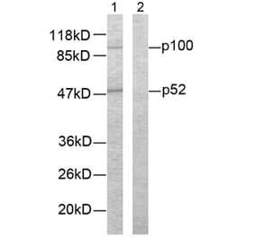 Western Blot - Anti-NF kappa B p100 / p52 Antibody (B7164) - Antibodies.com
