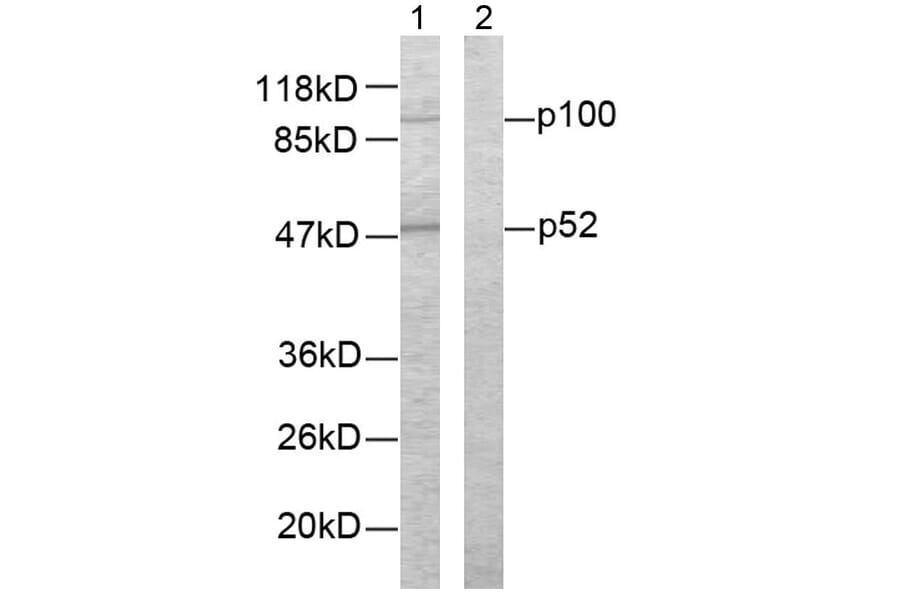 Western Blot - Anti-NF kappa B p100 / p52 Antibody (B7164) - Antibodies.com