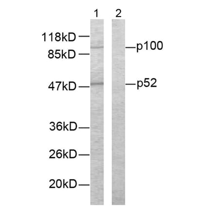 Western Blot - Anti-NF kappa B p100 / p52 Antibody (B7164) - Antibodies.com